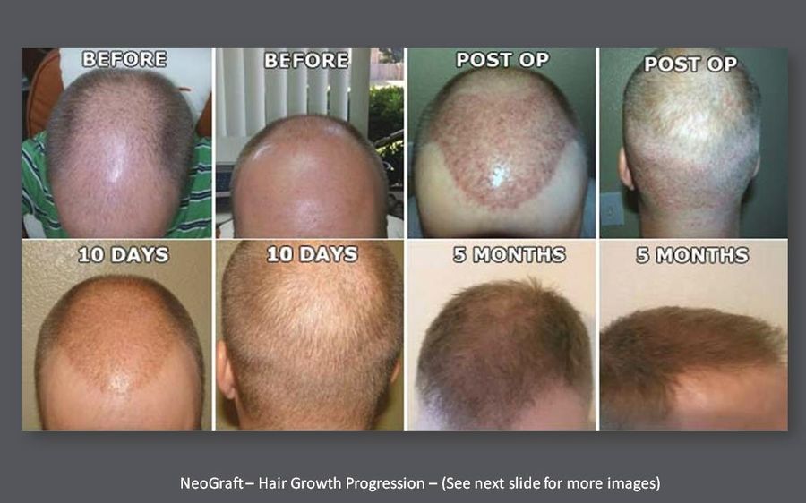 Kalos Hair Transplant LLC photo 3