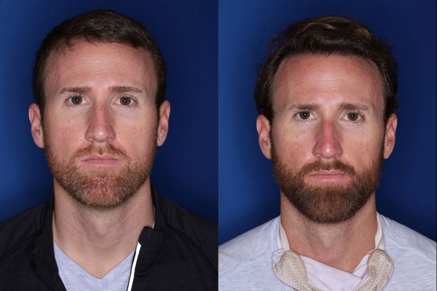 Kalos Hair Transplant LLC photo 4