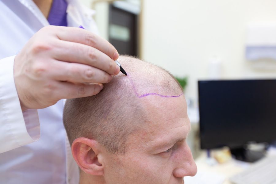 Cendant Stem Cell Hair Restoration and Transplant Clinic photo 4
