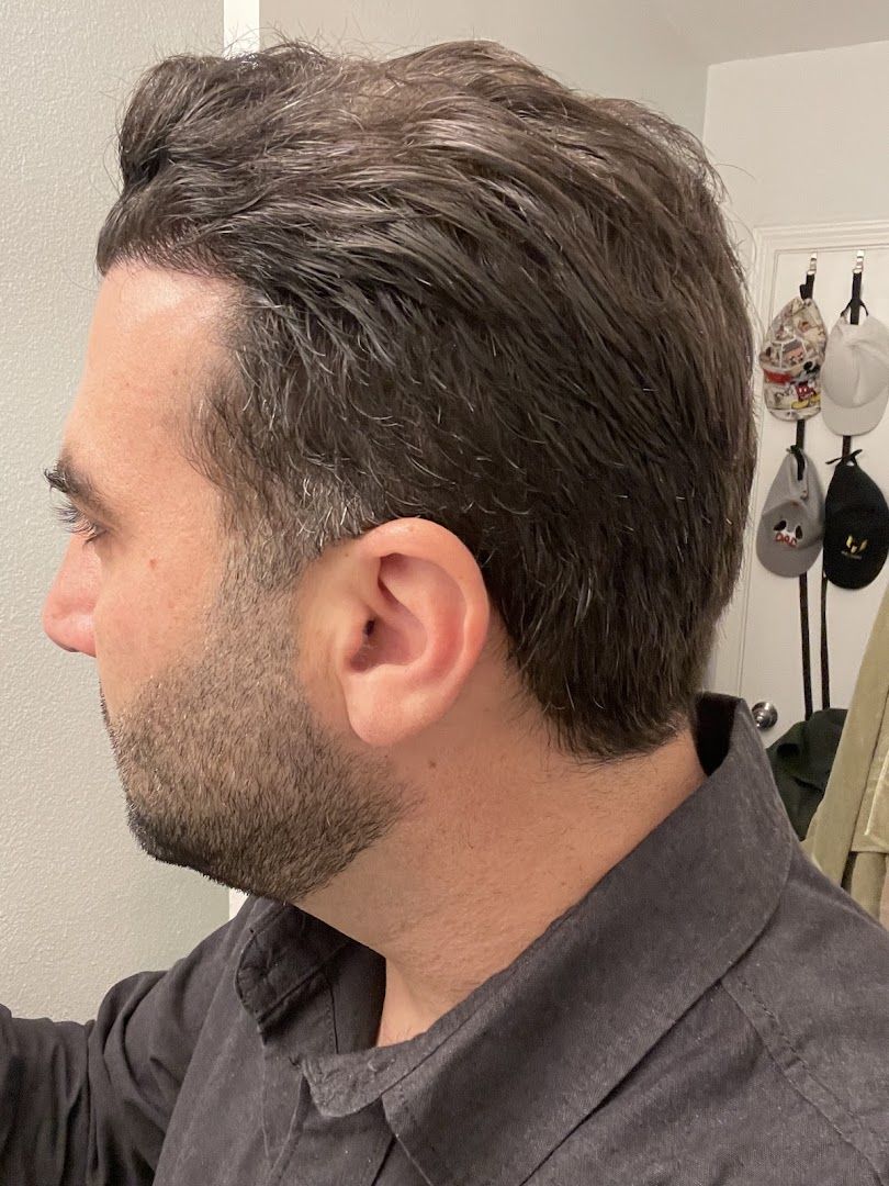 S3 Hair Transplant Clinic photo 2