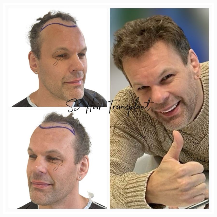 S3 Hair Transplant Clinic photo 4