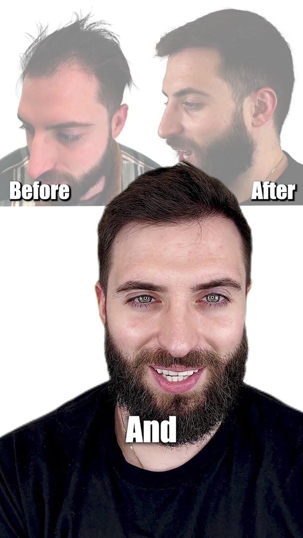 Maxim Hair Restoration & Transplants - Houston photo 2