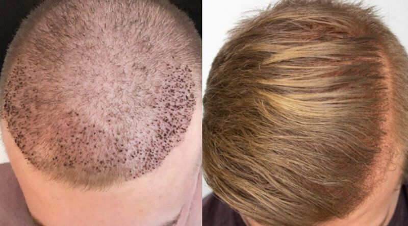 Aesthetic Hair Restoration photo 2