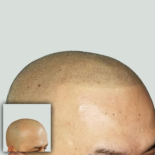 SCALP ARTIST INTERNATIONAL photo 2