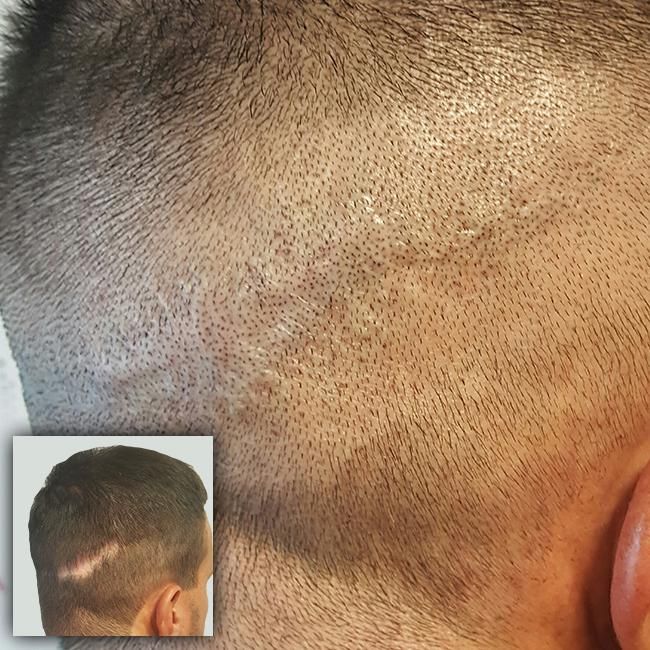 SCALP ARTIST INTERNATIONAL photo 3