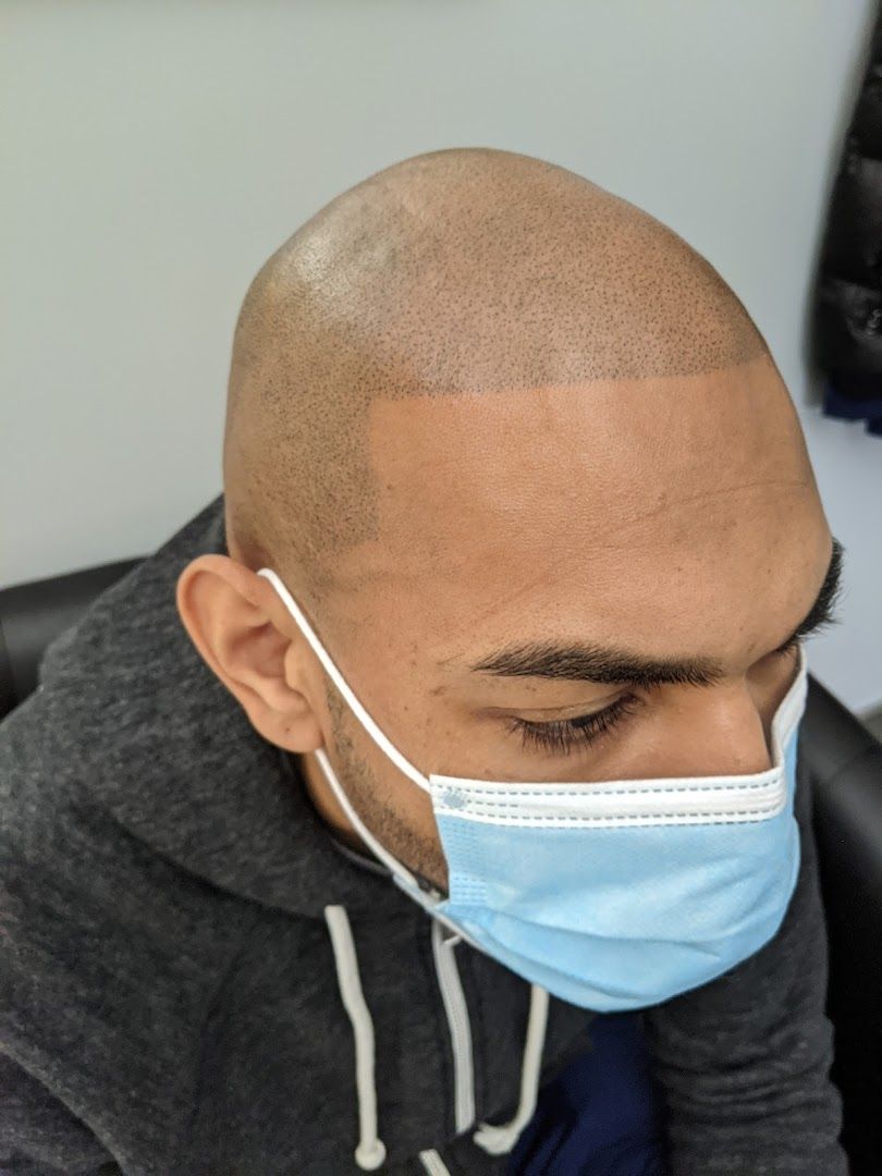 SCALP ARTIST INTERNATIONAL photo 4