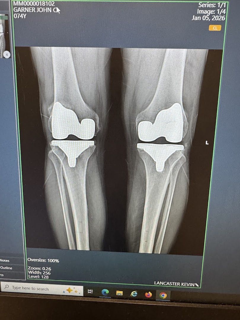 INOV8 Orthopedics photo 4