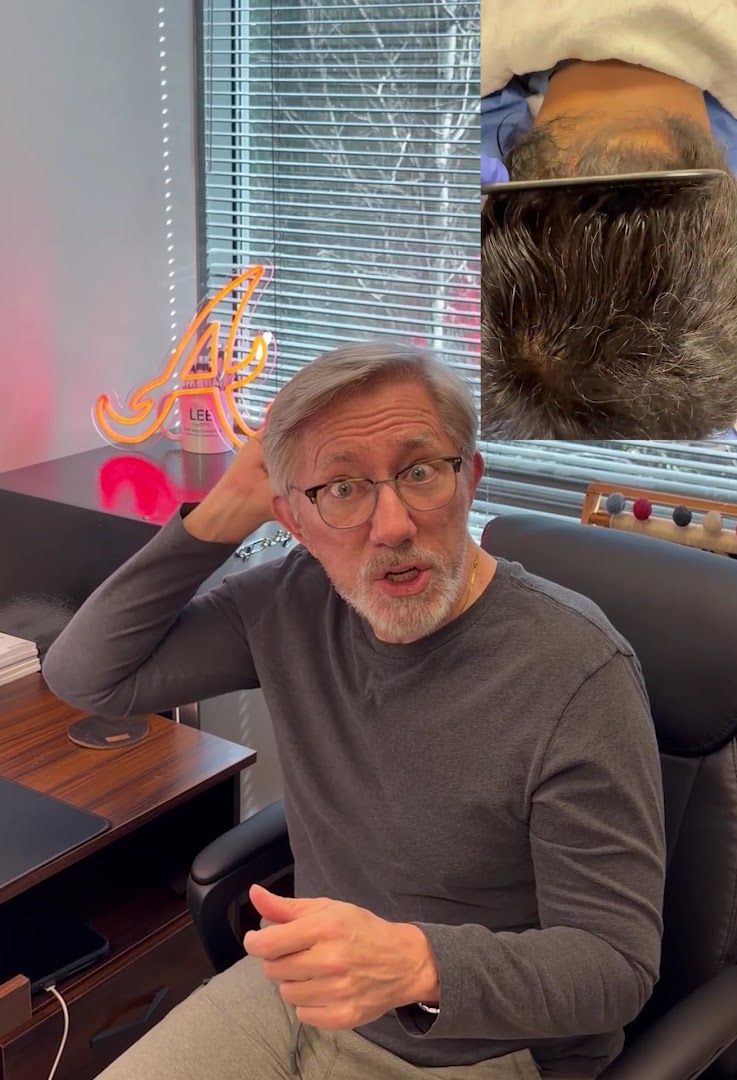 Lee Hair Restoration photo 3